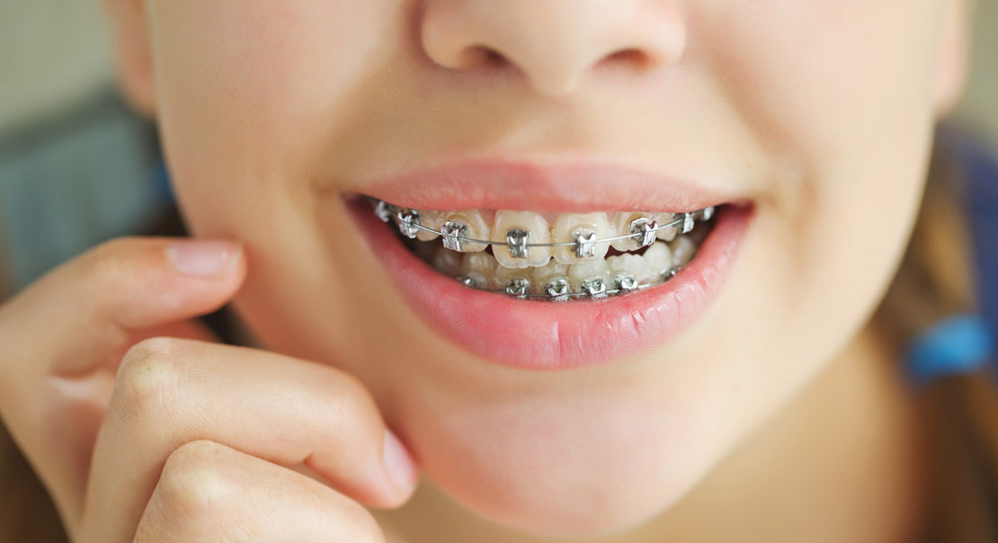 ارتودنسی دندان