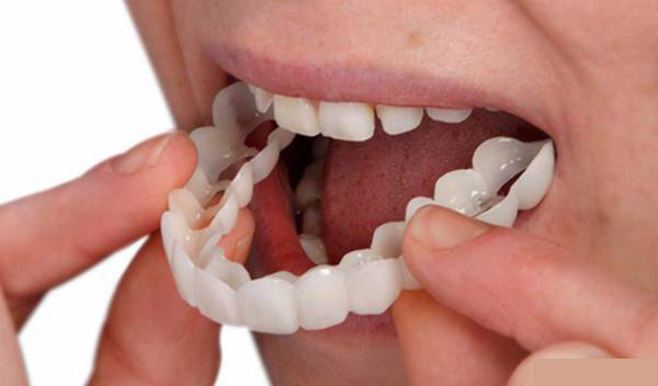 پروتز دندان متحرک