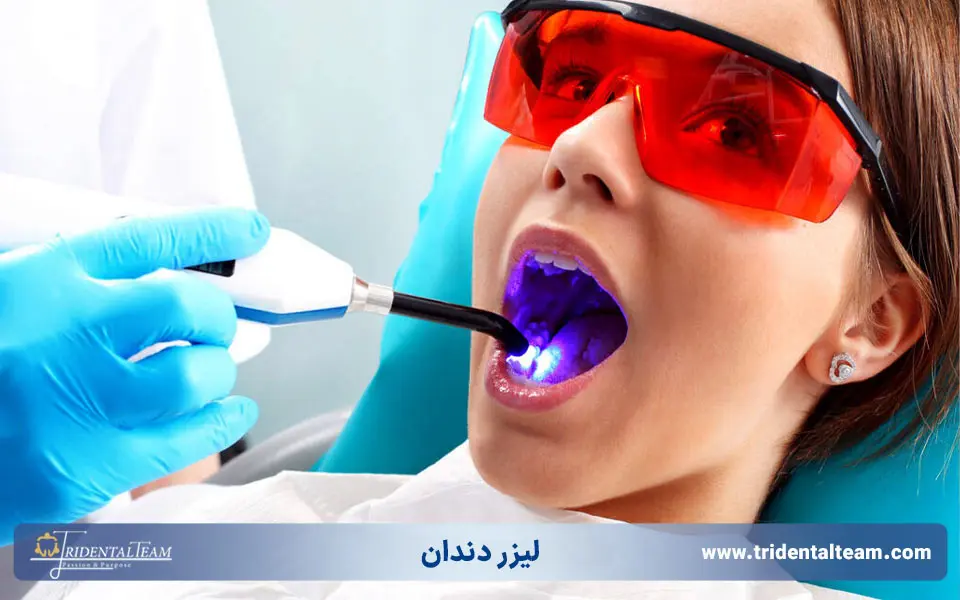 لیزر دندان