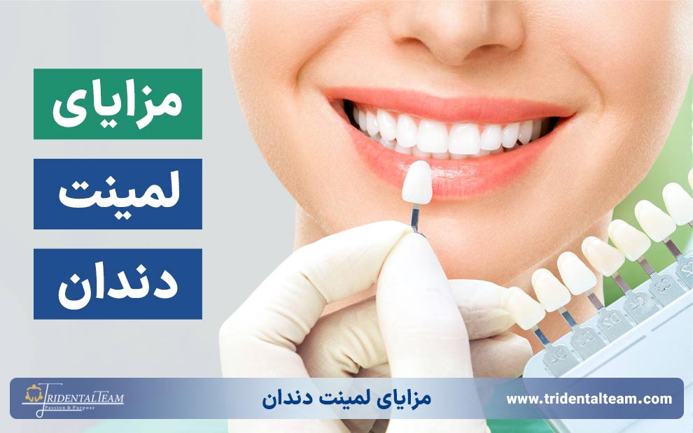 مزایای لمینت دندان