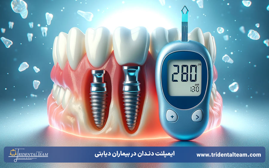 ایمپلنت دندان برای بیماران دیابتی