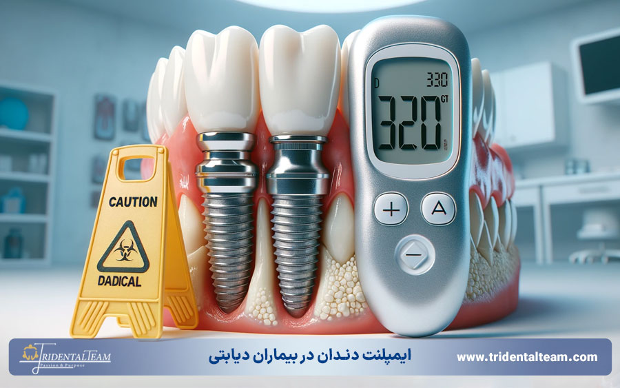 ایمپلنت دندان برای بیماران مبتلا به دیابت