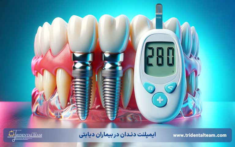 ایمپلنت دندان در بیماران دیابتی