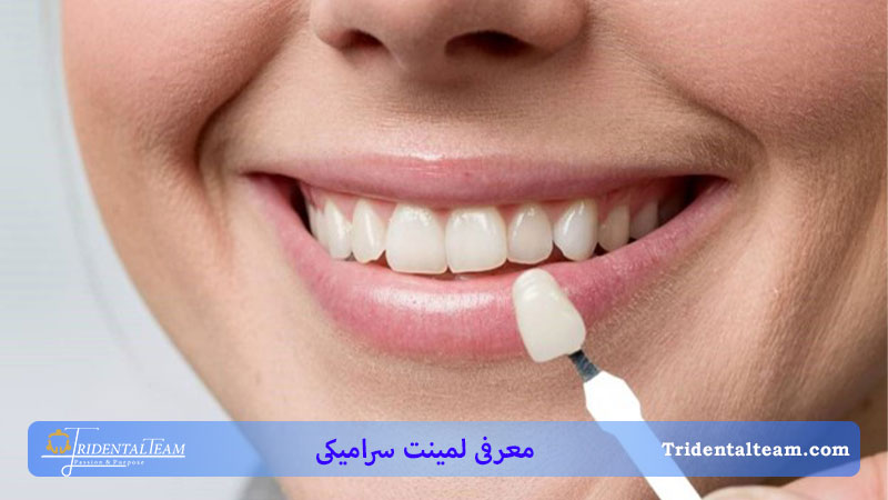 لبخندی با لمینت سرایکی