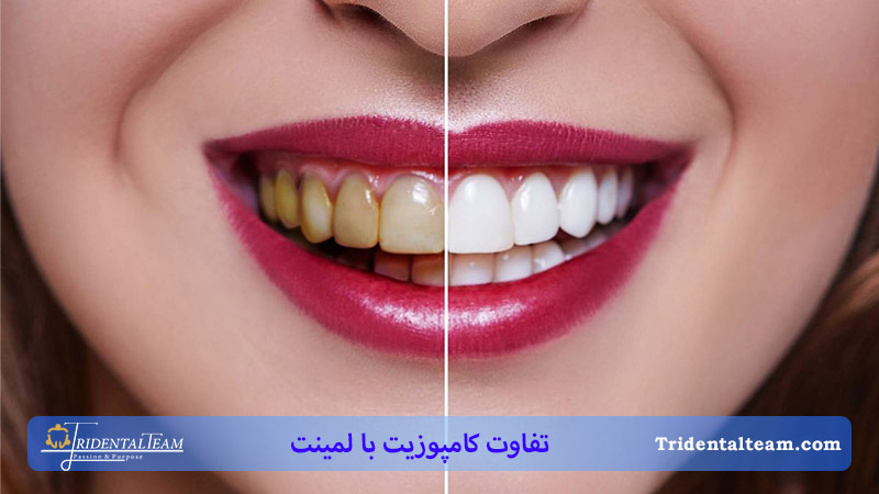 تفاوت لمینت و کامپوزیت