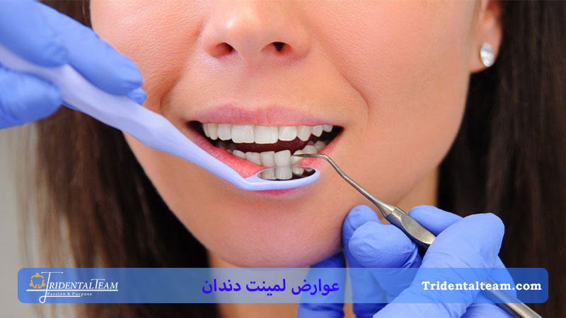 جلوگیری از عوارض لمینت