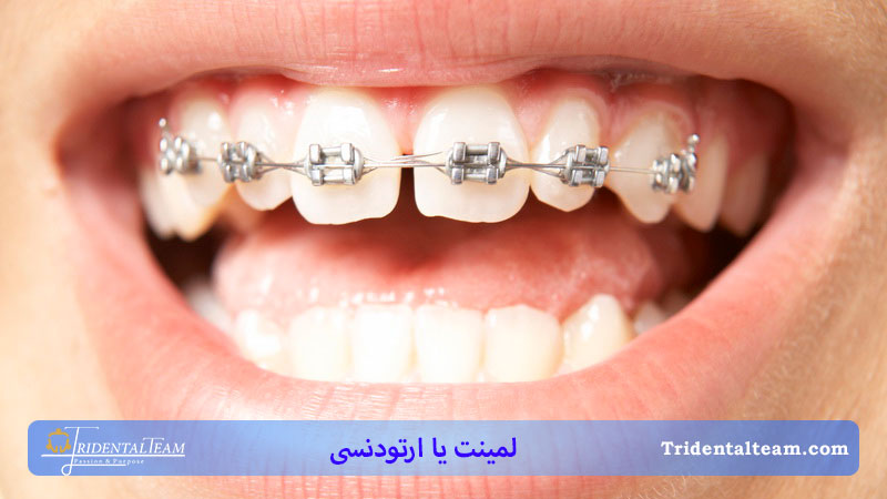 بررسی ویژگی هار ارتودنسی