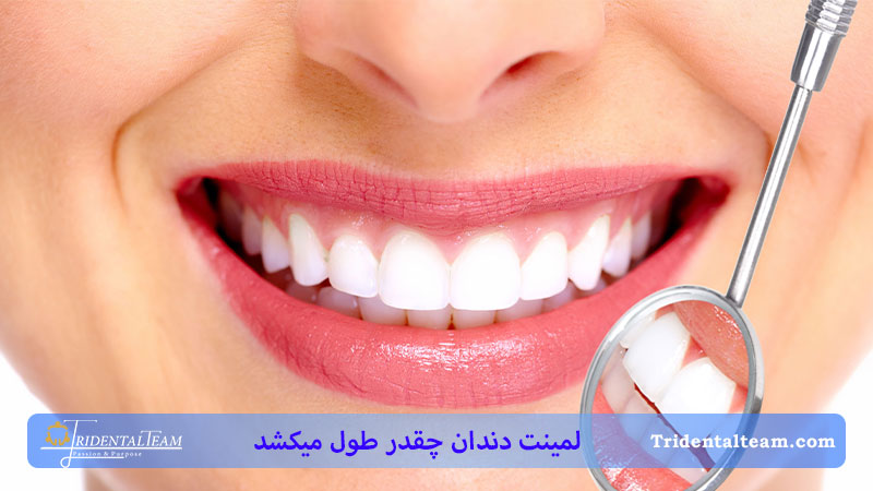 لمینت دندان چند جلسه نیاز دارد