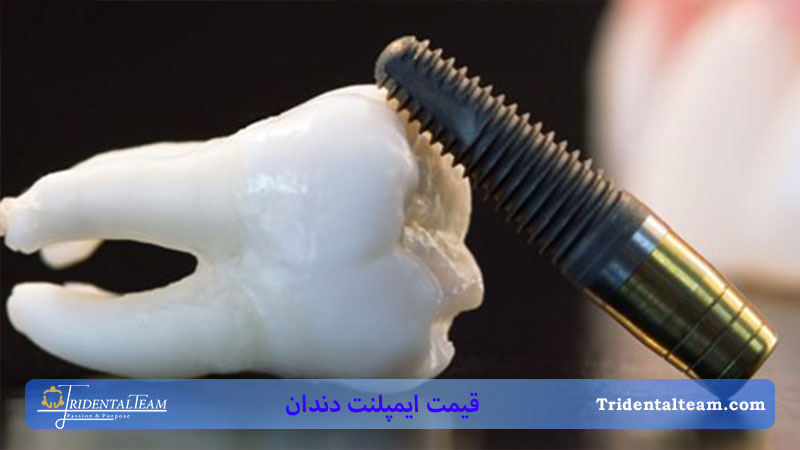 تصویری از میخ و دندان ایمپلنت