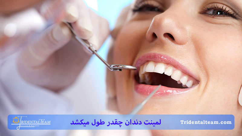 لمینت دندان چقدر طول میکشد