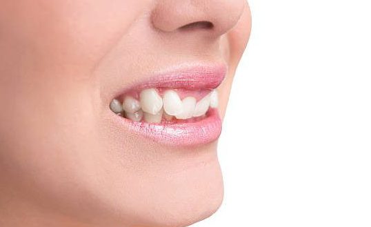 آندربایت چیست