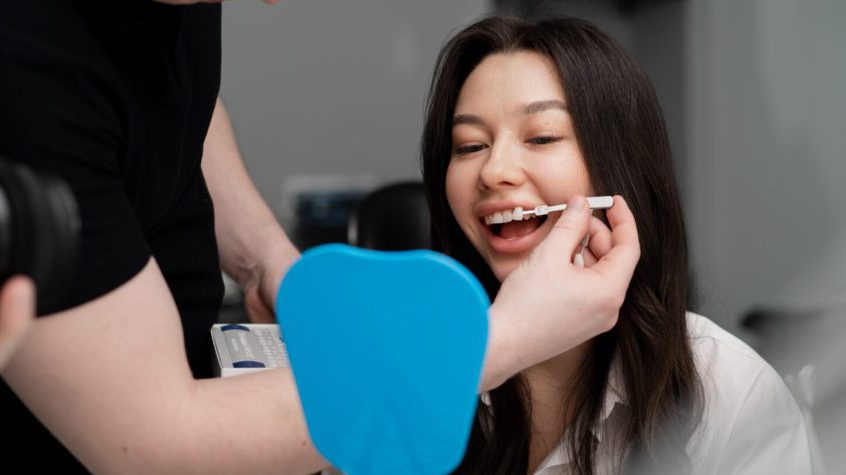 چسب روکش دندان