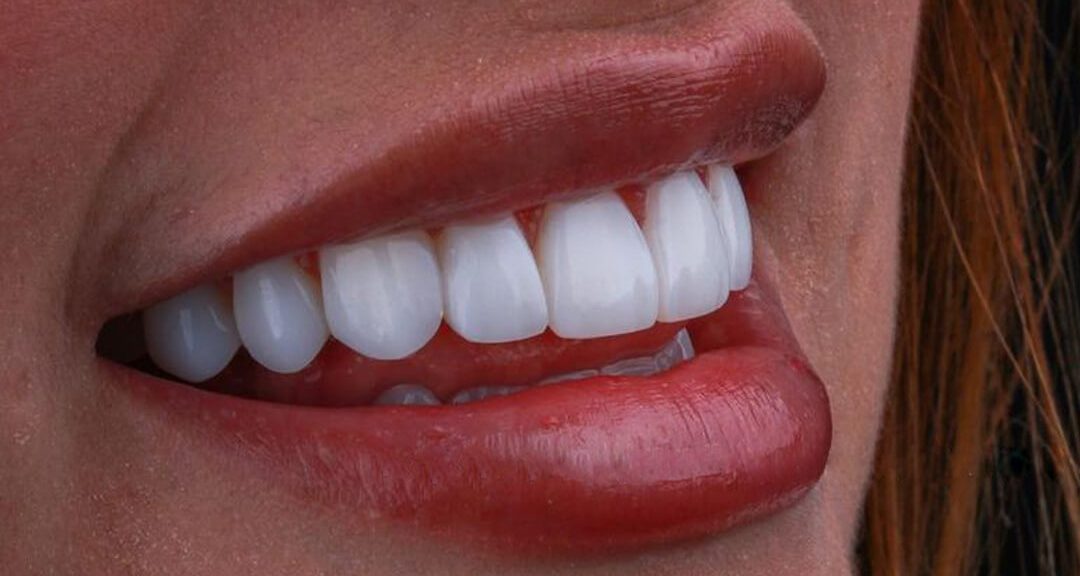 لمینت فلدسپاتیک