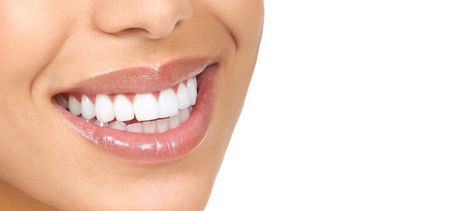 لمینت صدفی دندان