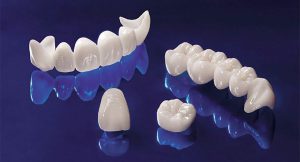 روکش زیرکونیوم