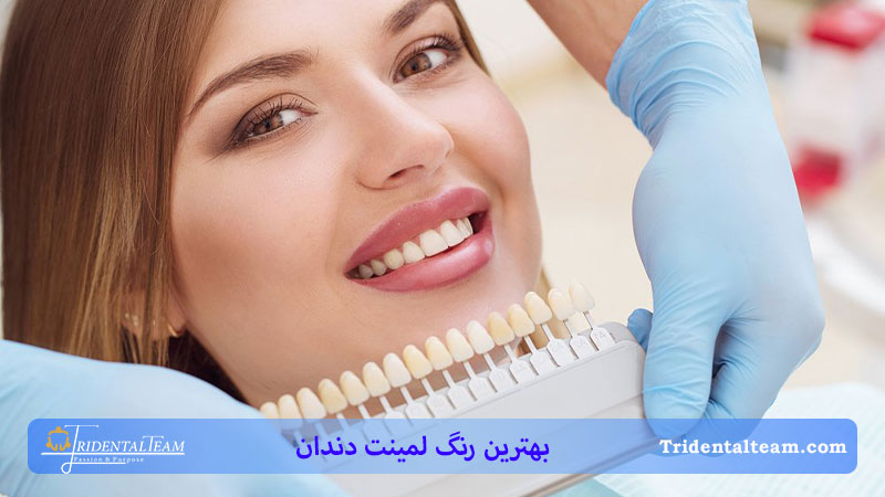 خانمی با رنگ لمینت دندان