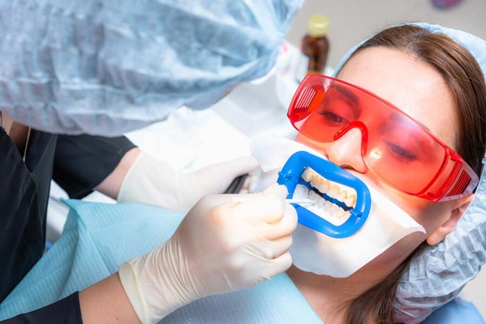 متخصص خوب بلیچینگ در تهران