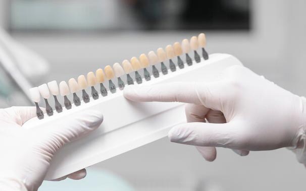 لمینت دندان در زعفرانیه