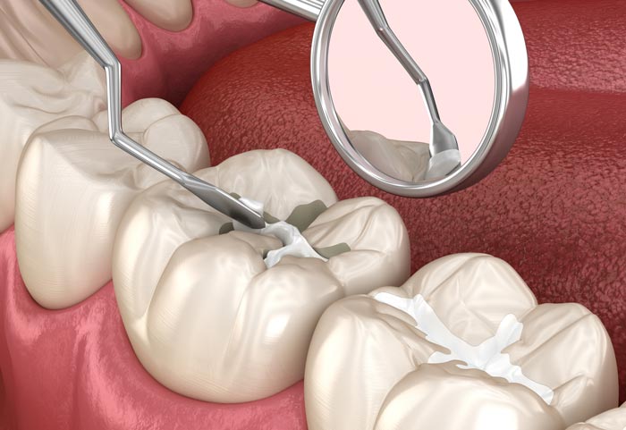 دندانپزشک ترمیمی در تهران
