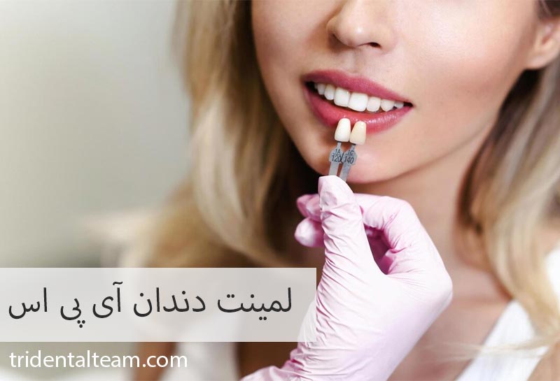 لمینت ای پی اس ips