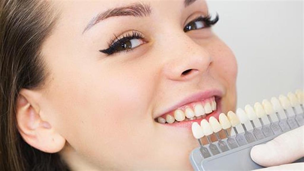 ۱۵ روش های زیبایی دندان در سال ۱۴۰۳