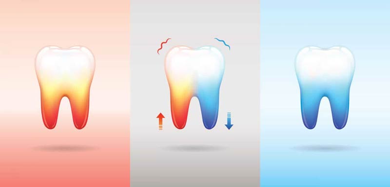 درمان حساسیت دندان بعد از کامپوزیت