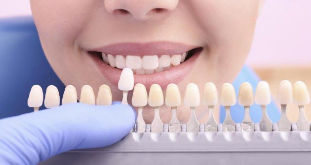 طبیعی ترین رنگ های کامپوزیت دندان