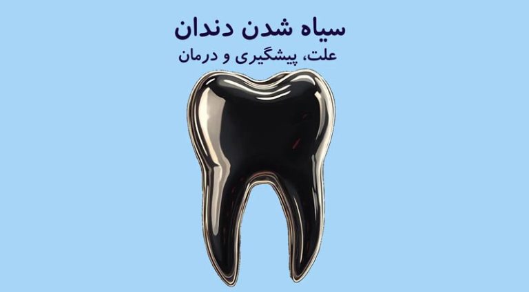 علت سیاه شدن دندان