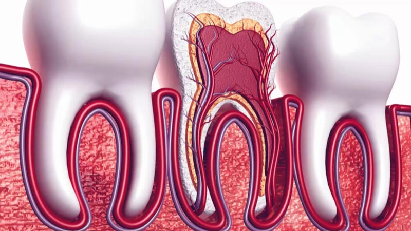 متخصص ریشه دندان تهران و زعفرانیه