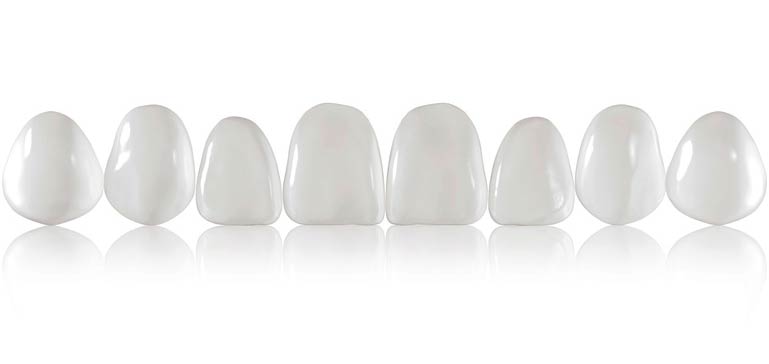 کامپوزیت ونیر دندان چیست