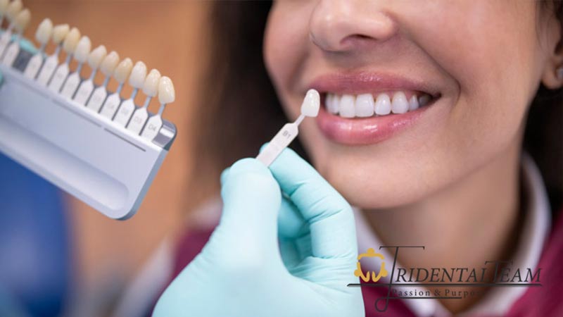 تفاوت لمینت و بلیچینگ