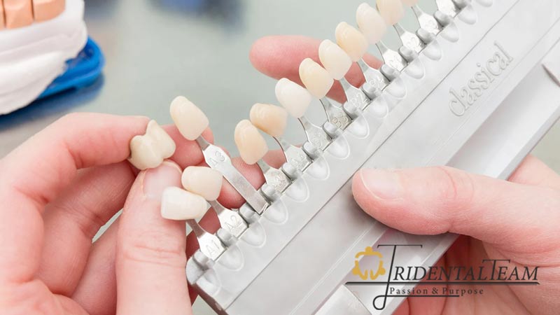 لمینت یا بلیچینگ دندان