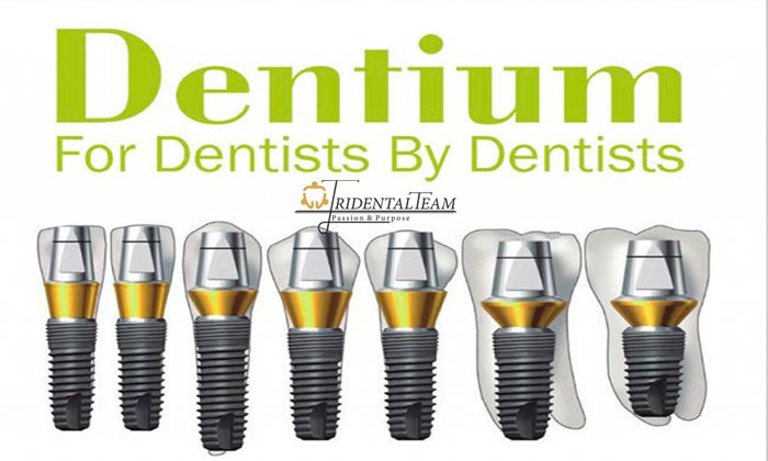 هزینه ایمپلنت کره ای