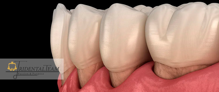 بهترین جراح لثه شمال تهران