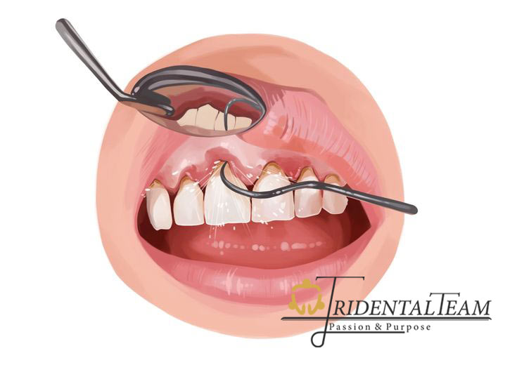 جراح لثه تهران
