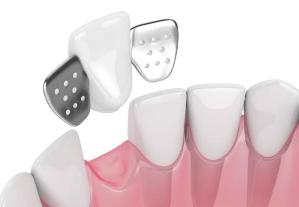 بریج مریلند چیست