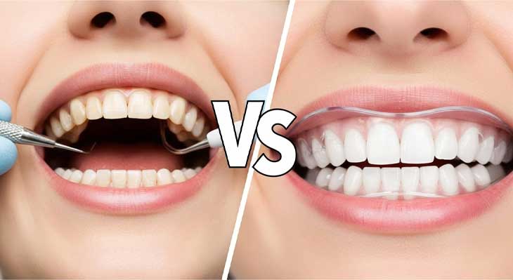 هوم بلیچینگ