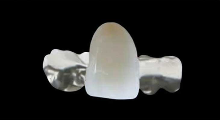 بریج دنباله دار یا مریلند