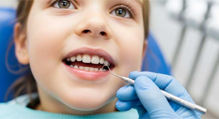 جرم گیری دندان کودکان