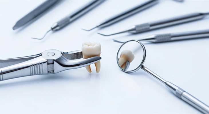 کشیدن دندان